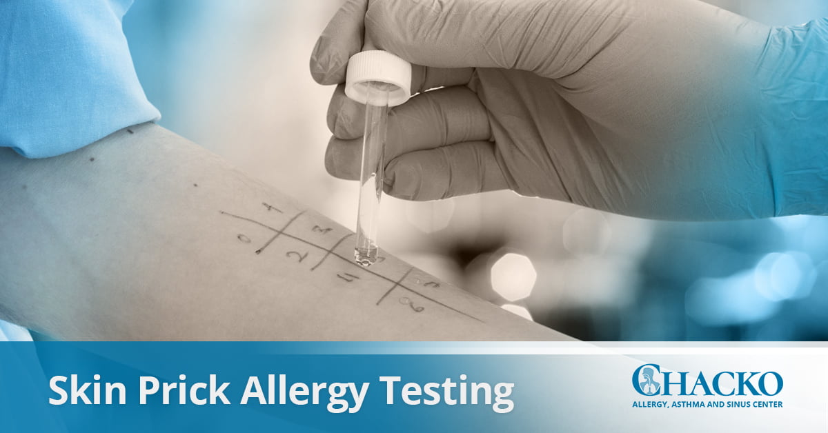 Skin Prick Allergy Testing