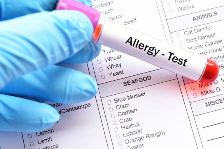 What Allergies Does Blood Allergy Testing Diagnose? Chacko Allergy