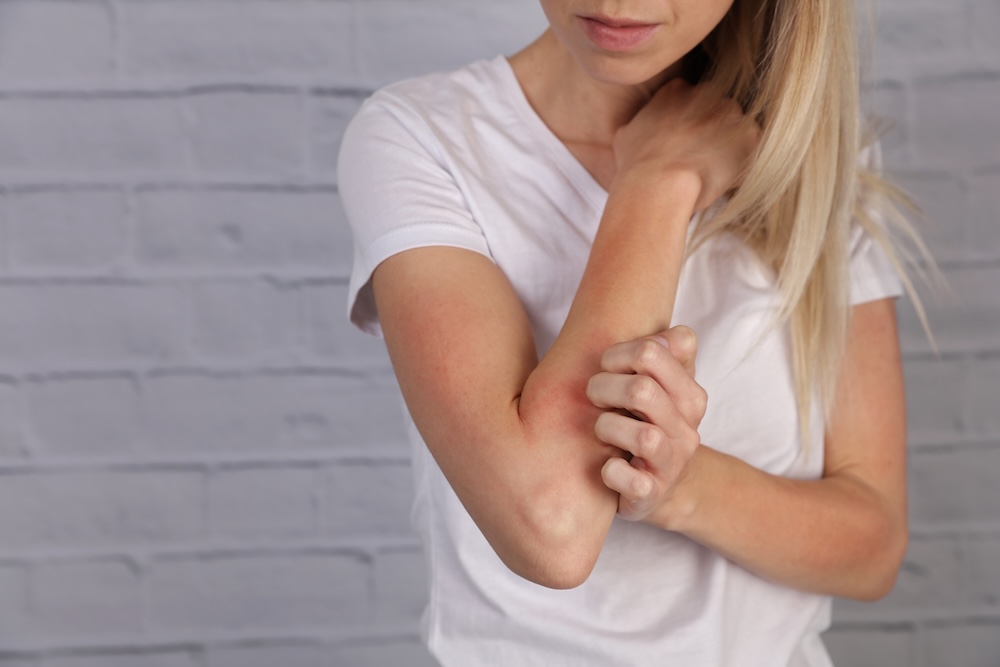 Atlanta-area skin allergy triggers.