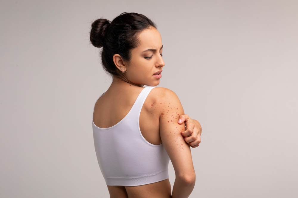 Atlanta skin allergy specialist.